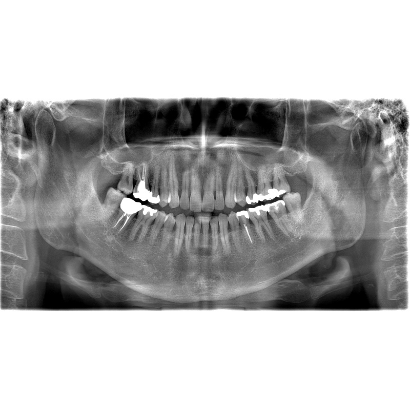 Flexdental