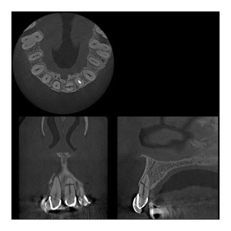 Flexdental