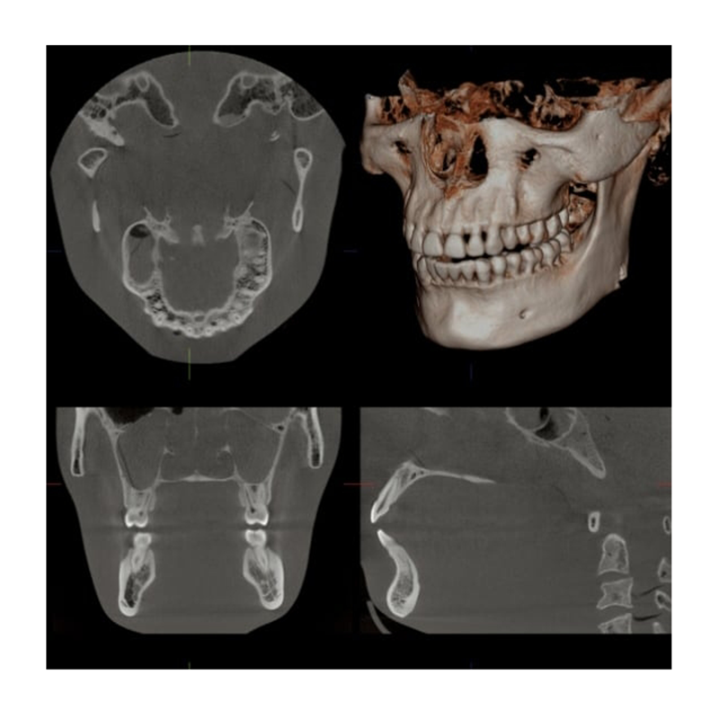 Flexdental